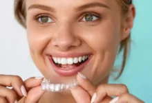 Photo of Factors and Tips to Consider for the Cost of Invisalign Treatment
