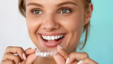 Photo of Factors and Tips to Consider for the Cost of Invisalign Treatment