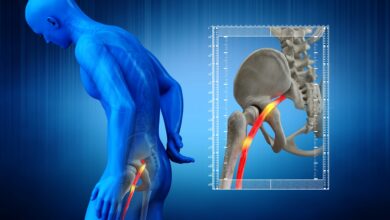 Photo of Unraveling Sciatica: Causes, Symptoms, and Pathways to Relief